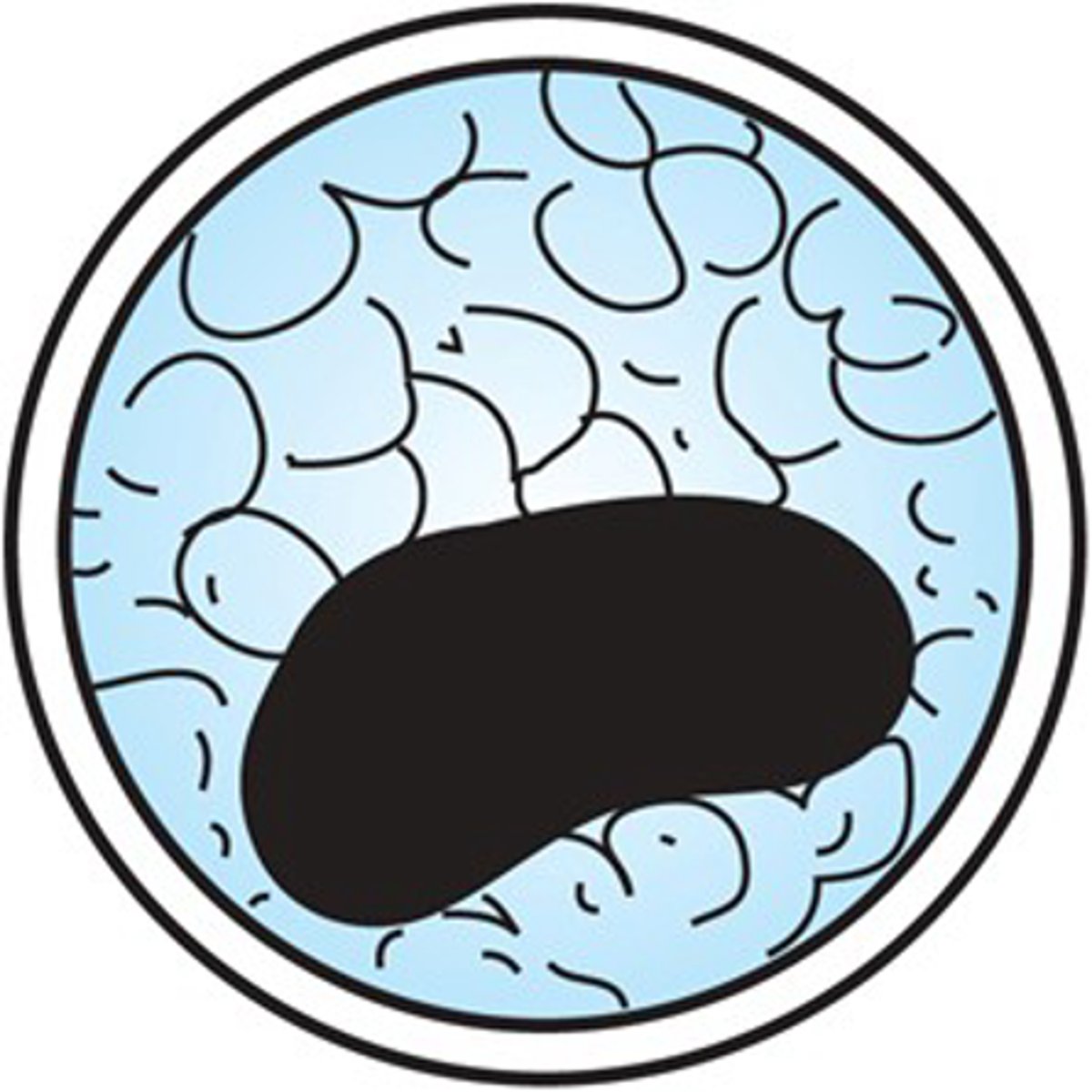 <p>This cyst stage of the kingdom Protista, phylum _______ is used to ensure survival of the</p><p>parasite in the environment.</p>