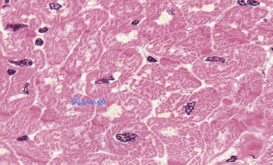 <p>Tejido muscular cardíaco </p>