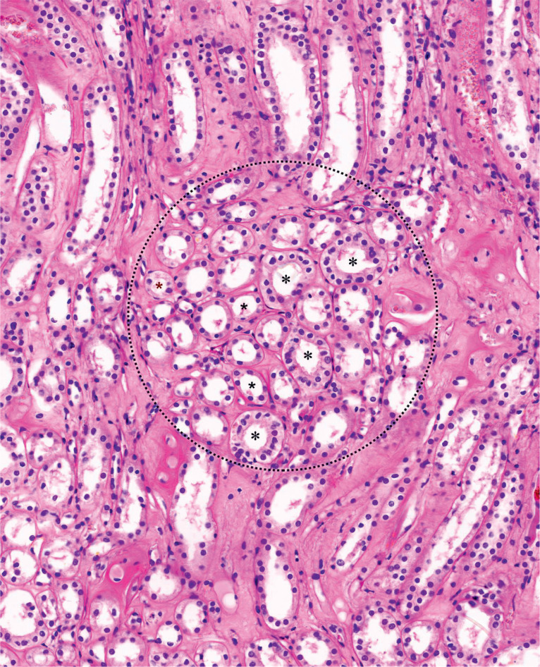 <p>Single row of flat cells with flat nuclei</p>