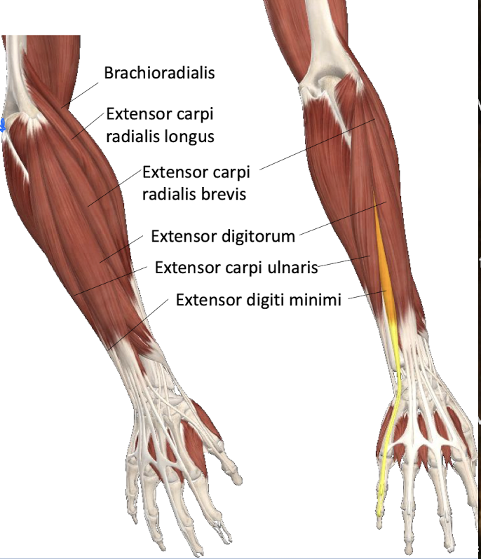 <p><strong>ALL INNERVATED BY THE RADIAL NERVE</strong></p><ul><li><p>Extensor carpi longus - Extend and abduct wrist</p></li><li><p>Brachioradialis - Elbow flexor</p></li><li><p>Extensor carpi radialis brevis - Extend and abduct wrist</p></li><li><p>Extensor carpi ulnaris - Extends and adducts wrist</p></li><li><p>Extensor digitorum - Main extensor of fingers</p></li><li><p>Extensor digiti minimi - Extensor of digit 5</p></li></ul><p></p>