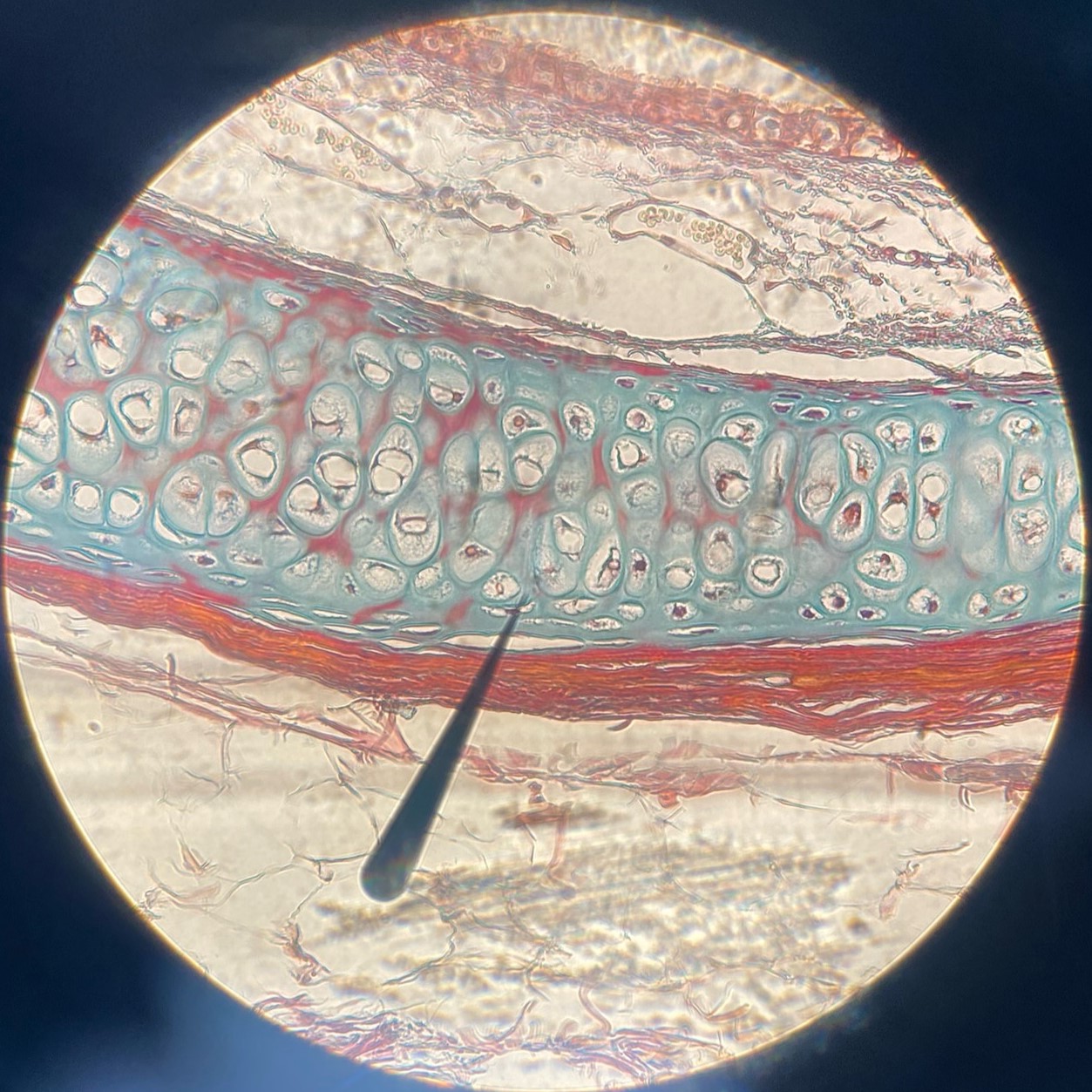 <p>example: trachea<br>function: produces and moves mucous<br><br>two or more layers thick and involved in protection; tall column-like ciliated</p>