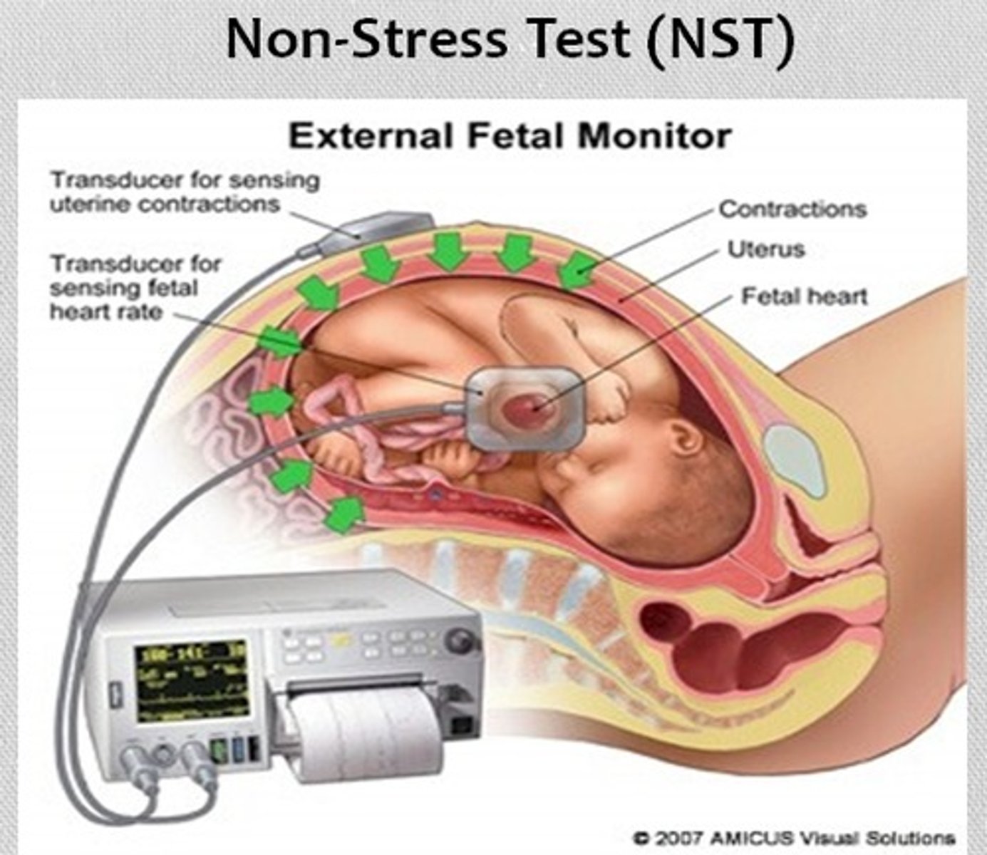 <p>most widely used technique for antepartum evaluation of fetal well being performed during the third trimester.</p>
