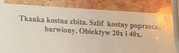 <p>komórki są wysycone solami wapnia co zapewnia im wytrzymałość na urazy mechaniczne</p>
