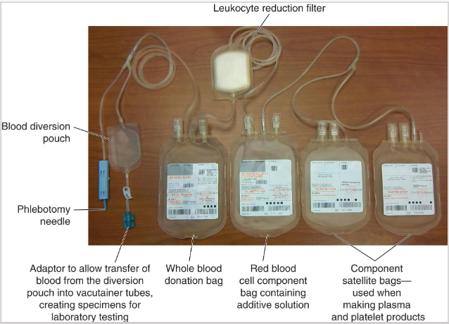 <ul><li><p><span><span>WB collection sets are available in a variety of configurations</span></span></p><ul><li><p><span><span>One primary bag to collect blood contains anticoagulant</span></span></p></li><li><p><span><span>Smaller bags (satellite) attached to main bag with plastic tubing</span></span></p></li><li><p><span><span>Large-bore needle (16 gauge) attached to collection set</span></span></p></li></ul></li></ul><p></p>
