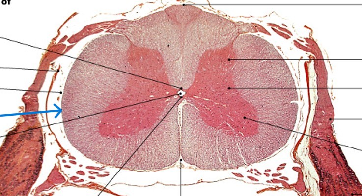 <p>Which meningeal layer is:</p><ul><li><p>Innermost meningeal layer</p></li><li><p>A mesh of collagen and elastic fibers</p></li><li><p>Bound to underlying neural tissue</p></li></ul><p></p>