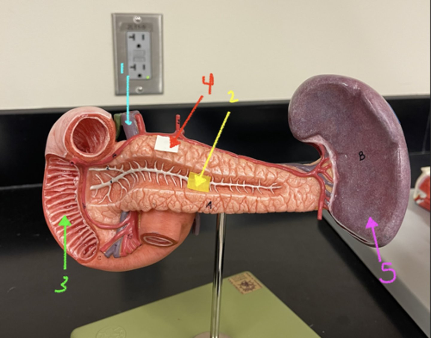 <p>what is structure 1</p>