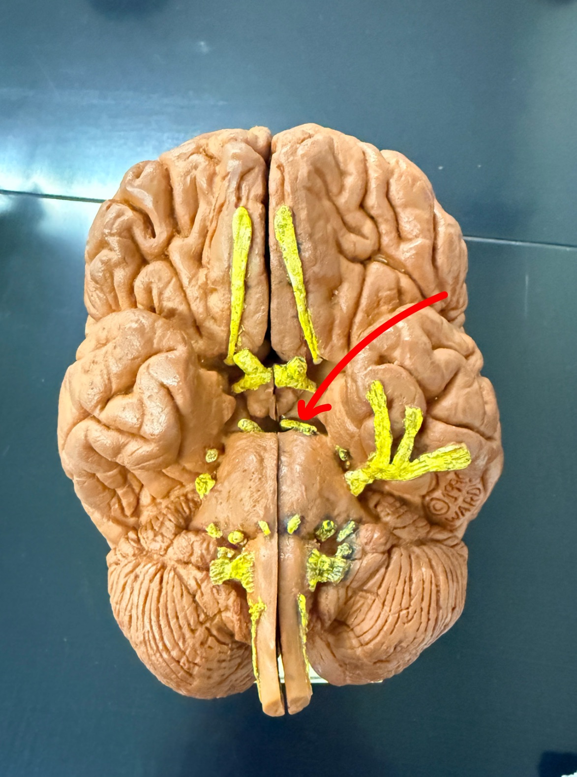 <p>Name the cranial nerve on the brain model</p>