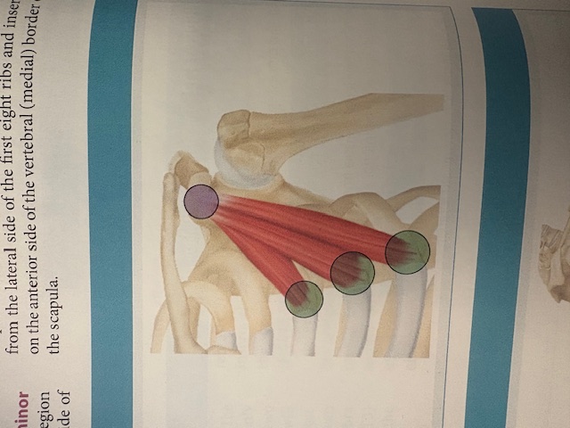 <p>Pectoralis Minor </p>