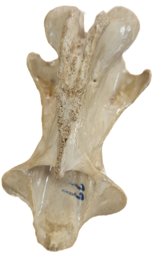 <p>Segunda vértebra cervical</p>