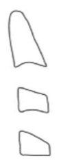 <ul><li><p>concavities at lower borders of both C2 and C3</p></li><li><p>C3 and C4 are either trapezoid or rectangular horizontal shaped</p></li><li><p>peak growth is less than 1 year ahead</p></li><li><p>ideal stage to begin functional jaw orthopaedics for class II</p></li></ul><p></p>
