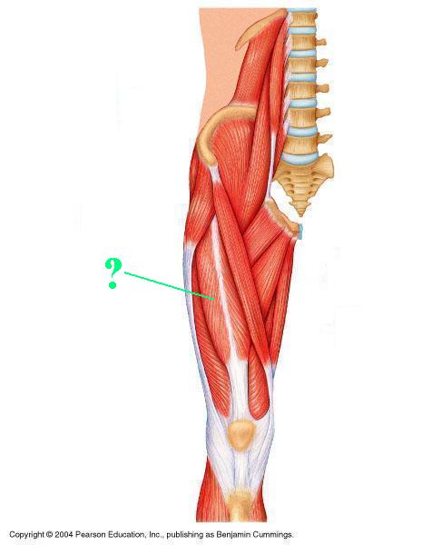 <p><span>Identify the indicated muscle</span></p>