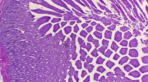 <p>What is the histology?</p>