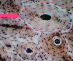 <p>structural unit of compact bone</p>