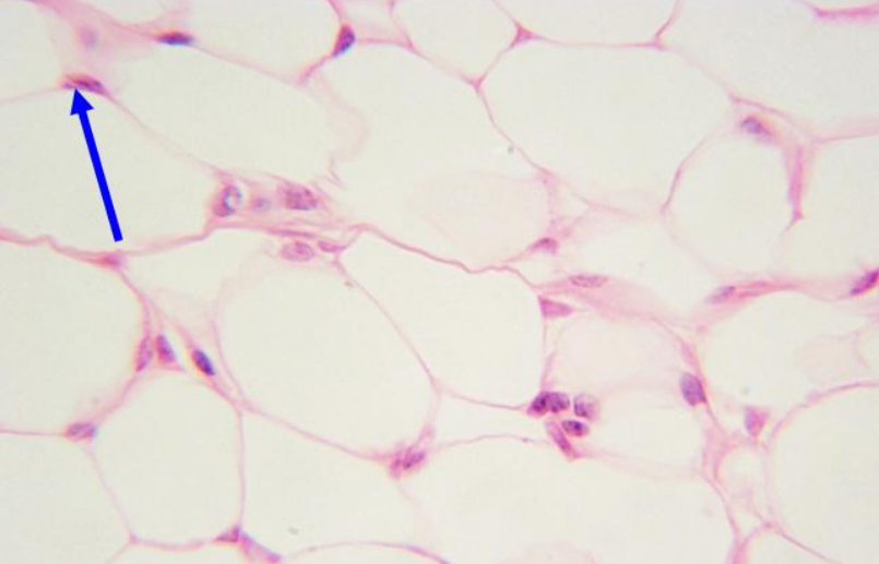 <p>What is the arrow pointing to?</p>