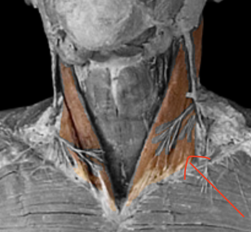 <p>What muscle is this? </p>