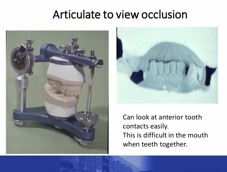 <p>articulator for planning treatment such as fixed and removable prosthodontics</p><p>enables you to see how teeth occlude</p><p>in the image it allows you to see the extent of the overbite which you wouldn’t be able to see from the patient</p><p>can be used when discussing treatment plans and discussing how to maintain their teeth and restorations</p>