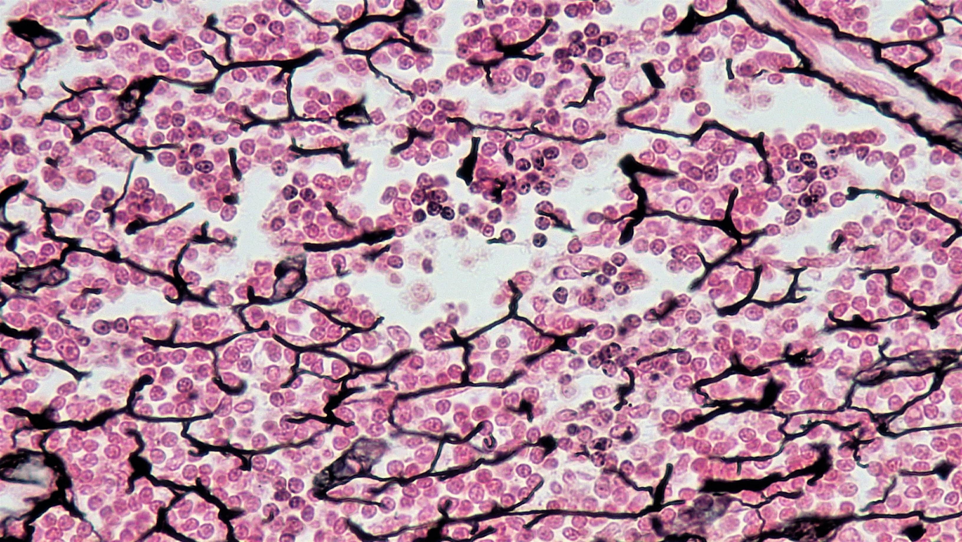 <p>Reticular tissue</p>