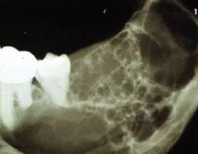 <p>how would you describe this lesion? </p>