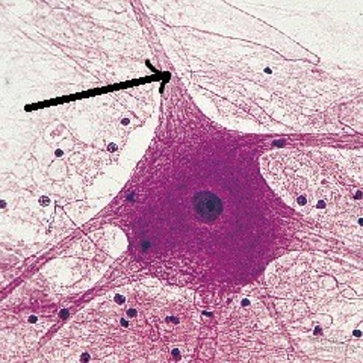 <p>incapable of protein synthesis and is the site of synaptic output</p>