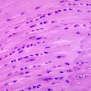 <p>describe Fibrocartilage</p>