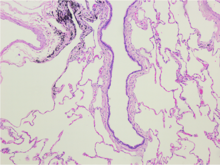 <p><span>By the presence of submucosa and cartilage rings in the cross section</span></p>