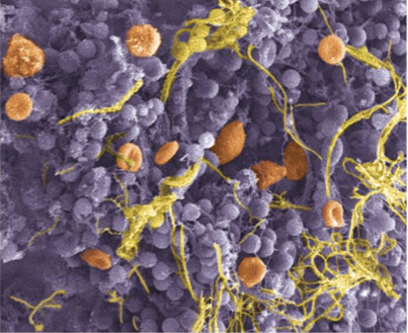 <ul><li><p>Organized layer of accumulated bacteria and other microbes living together on a surface via their fimbriae</p></li><li><p>Biofilms are hard to get rid of, cause many industrial problems</p></li><li><p>However beneficial in water treatment systems</p></li></ul><p></p>
