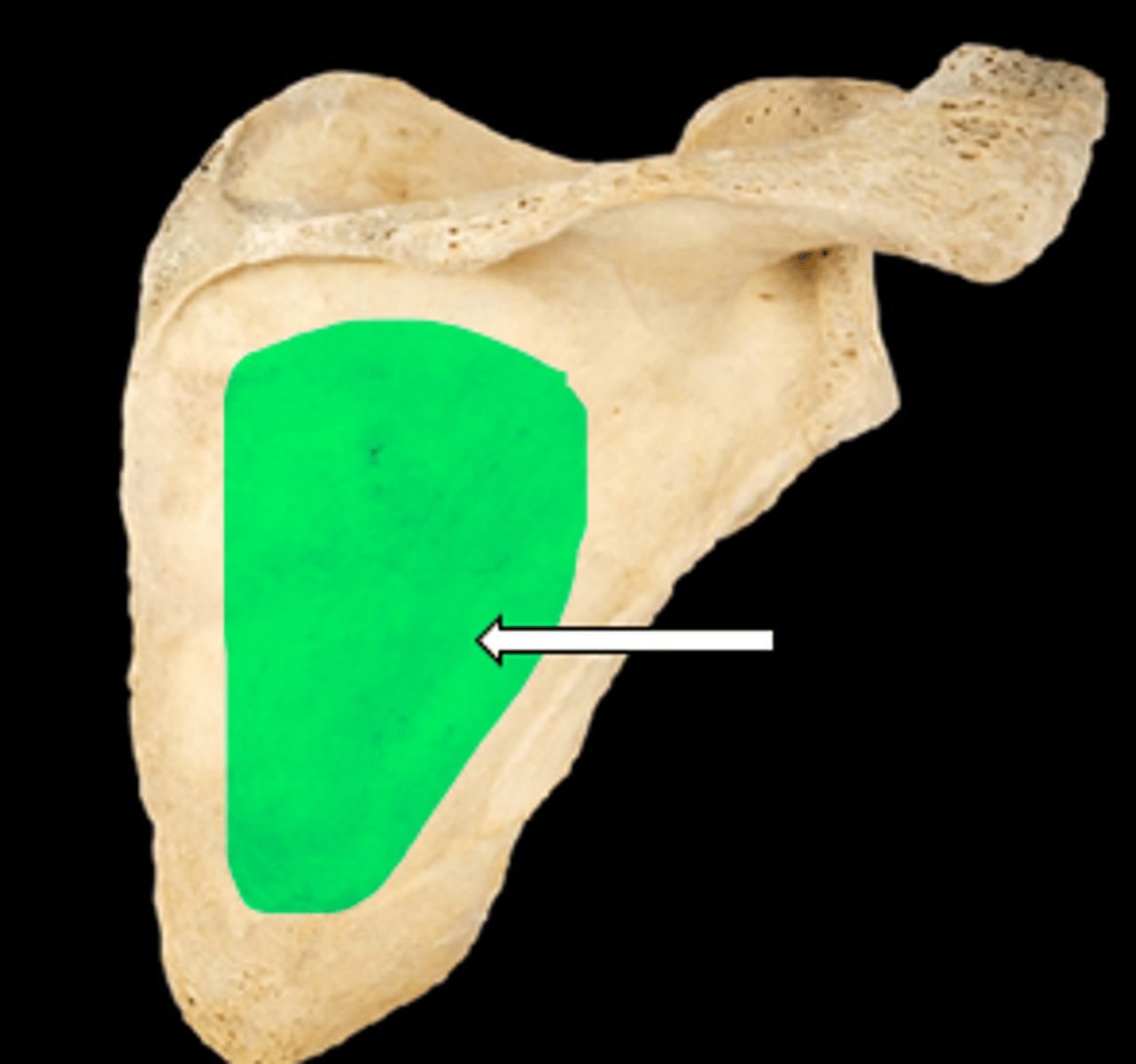 <p>name the part</p>
