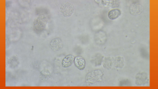 <p>What does Klossiella equi cause?</p>