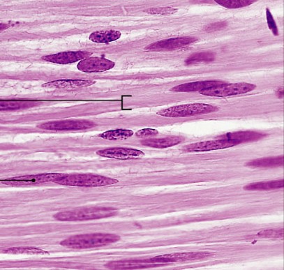 <p>Which type of muscle is:</p><ul><li><p>Nonstriated, involuntary</p></li><li><p>Long and spindle-shaped, single nucleus</p></li><li><p>Walls of blood vessels, digestive tact</p></li></ul><p></p>