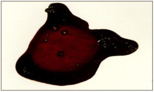 -A bloodstain pattern created when a source of blood remains stationary over a surface causing an accumulation of blood