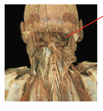 <p>What is this muscle What is its origin. Where does it inserts. </p>