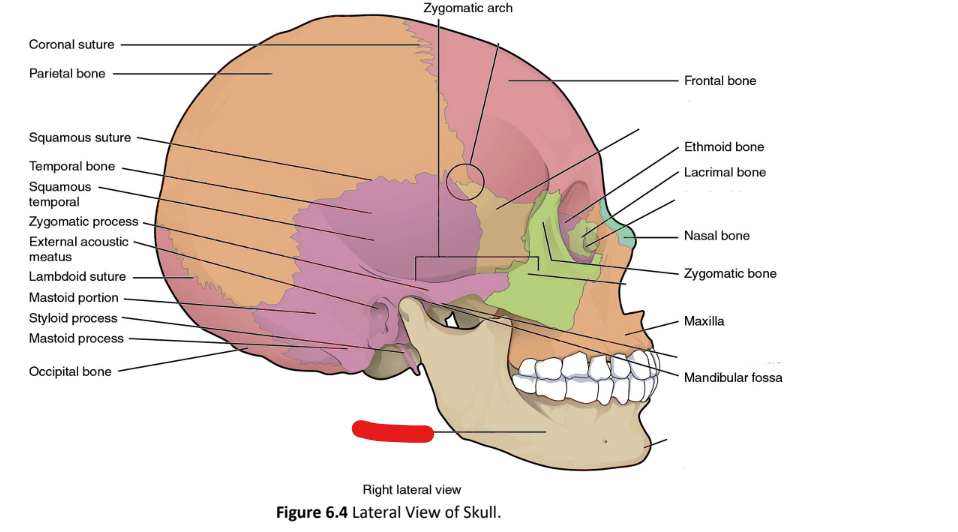 term image