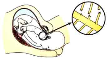 <p>Brachial plexus injuries</p>