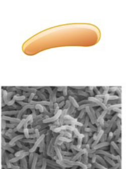 <p>What type of bacteria is this?</p>