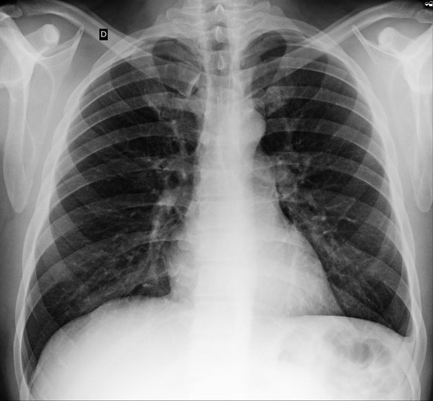 <p>Describe the abnormality demonstrated.</p>
