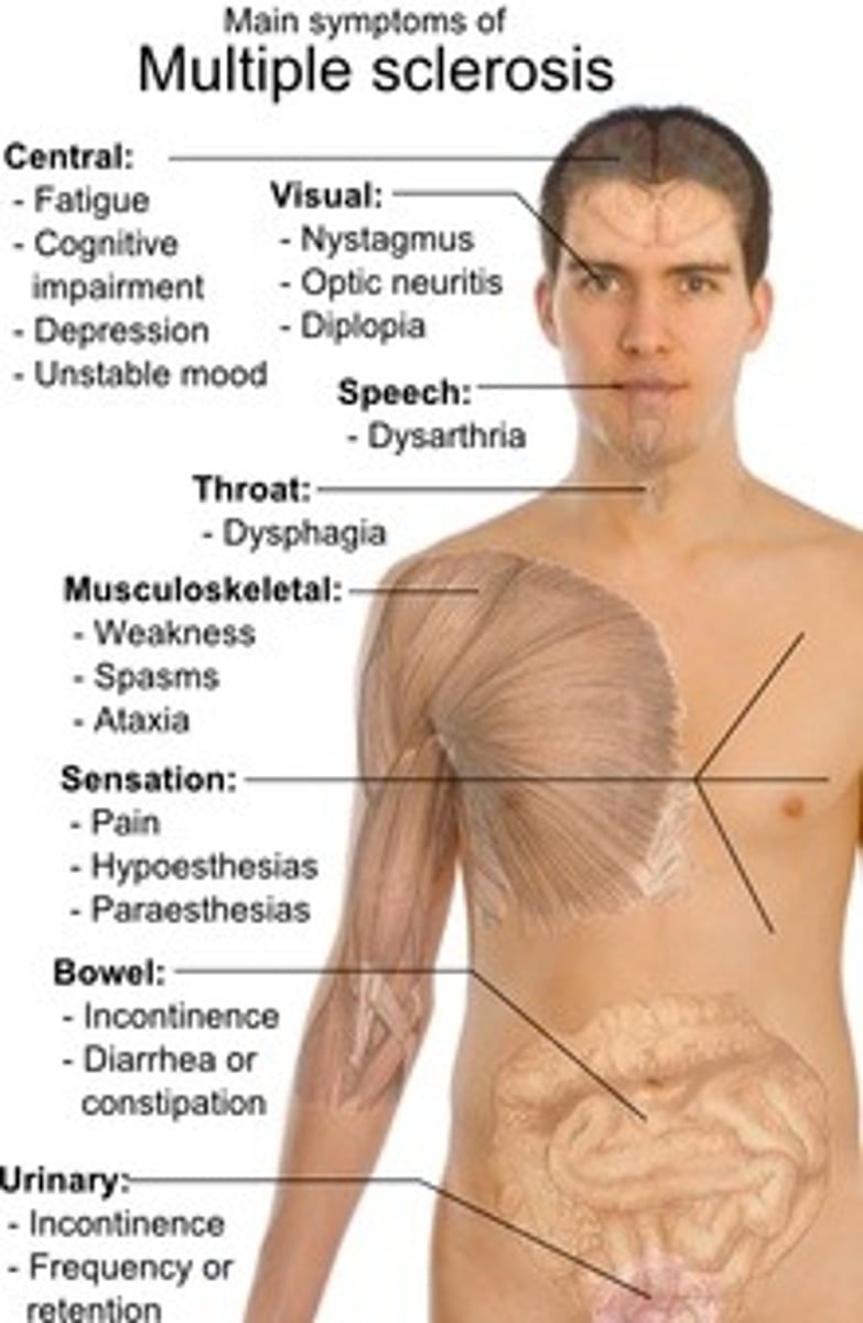 <p>foreign antigen, leading to autoimmune diseases such as diabetes, rheumatoid arthritis, and multiple sclerosis.</p>