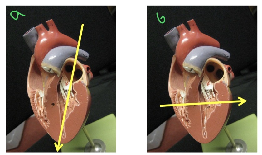 <p>Short axis view </p>