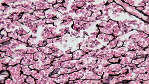 <ul><li><p>DESCRIPTION: loose connective tissue made up of a network of reticular fibers</p></li><li><p>FUNCTION: provides a supportive framework for soft organs and resists distortion</p></li><li><p>LOCATION: found in liver, kidney, spleen, lymph nodes, and bone marrow</p></li><li><p>reticular fibers create a complex supporting network known as a stroma (framework)</p></li></ul><p></p>