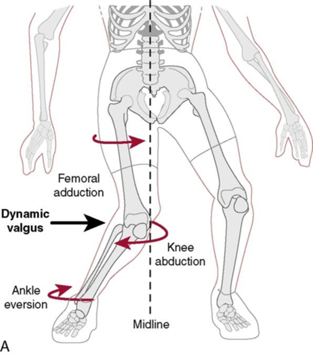 <p>- condition happens when person is moving "dynamic"</p><p>- happens during functional activities</p>