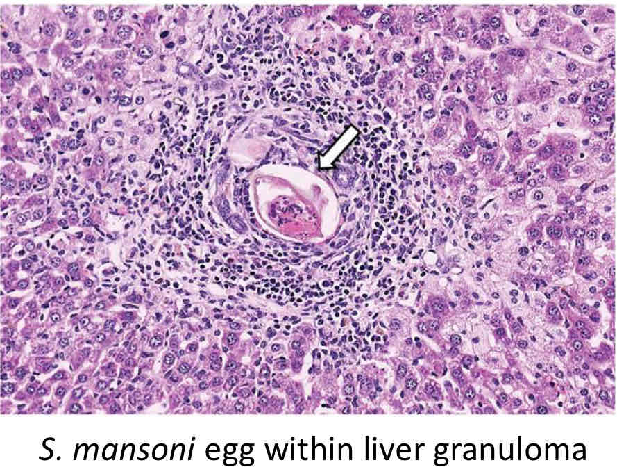 <p>Eggs transverse host tissue, remain in host tissues</p><p>Eggs also travels to Liver, CNS, lungs, etc. </p>