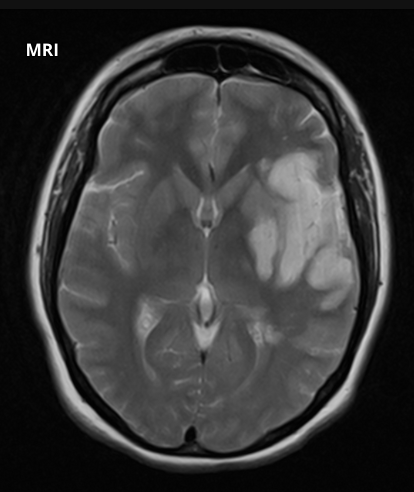 <p>What does this image show?</p>