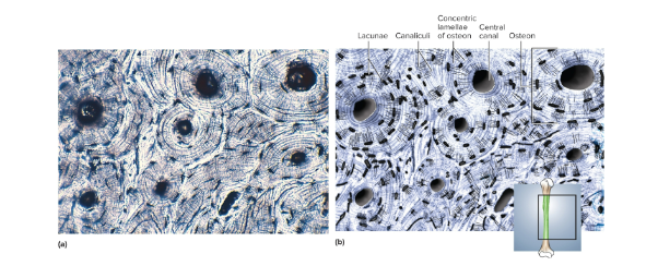 <p>Bone (osseous) tissue</p>