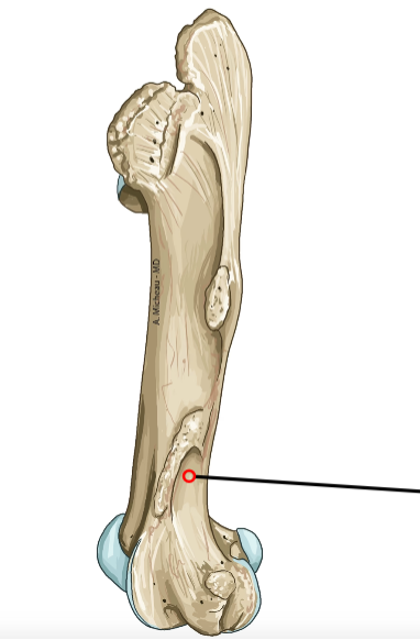 <p>Shallow depression above lateral condyle; origin of gastrocnemius.</p>