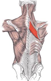 <p><span>Medial border of scapula</span></p>