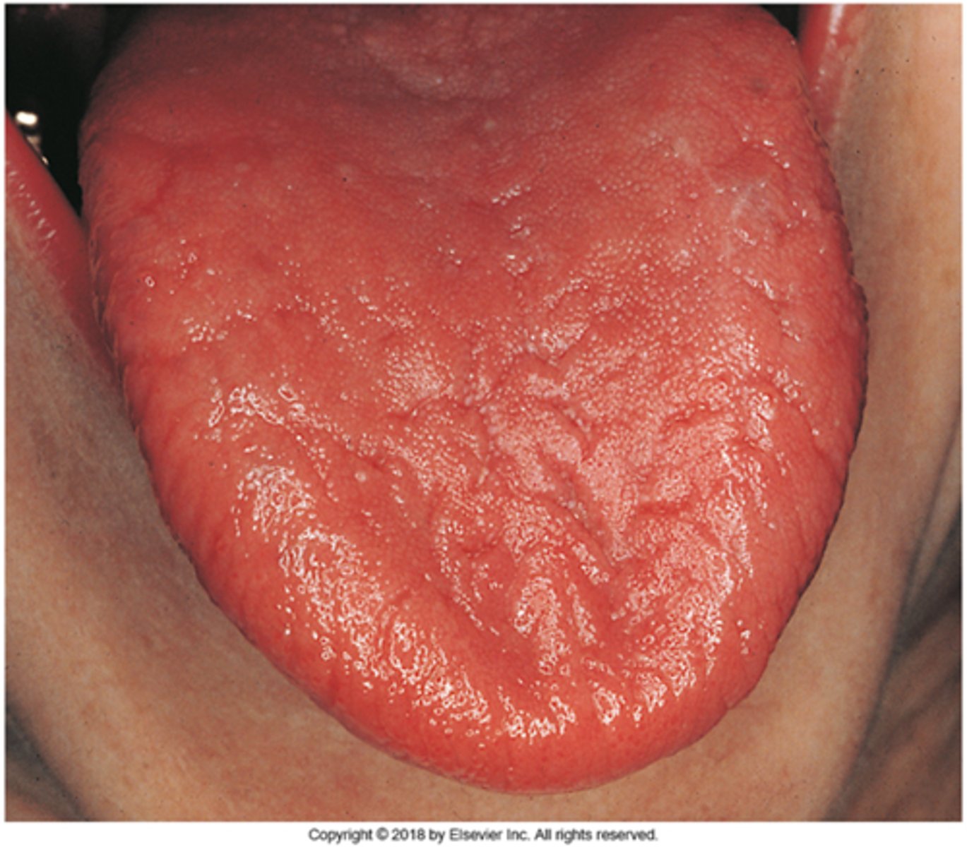 knowt flashcard image