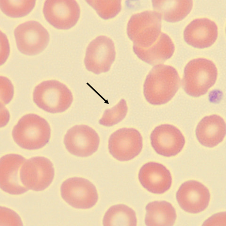 <p>What is the shape of this erythrocyte?</p>