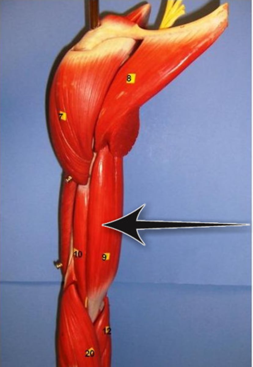 <p>Identify what the arrow is pointing to</p>