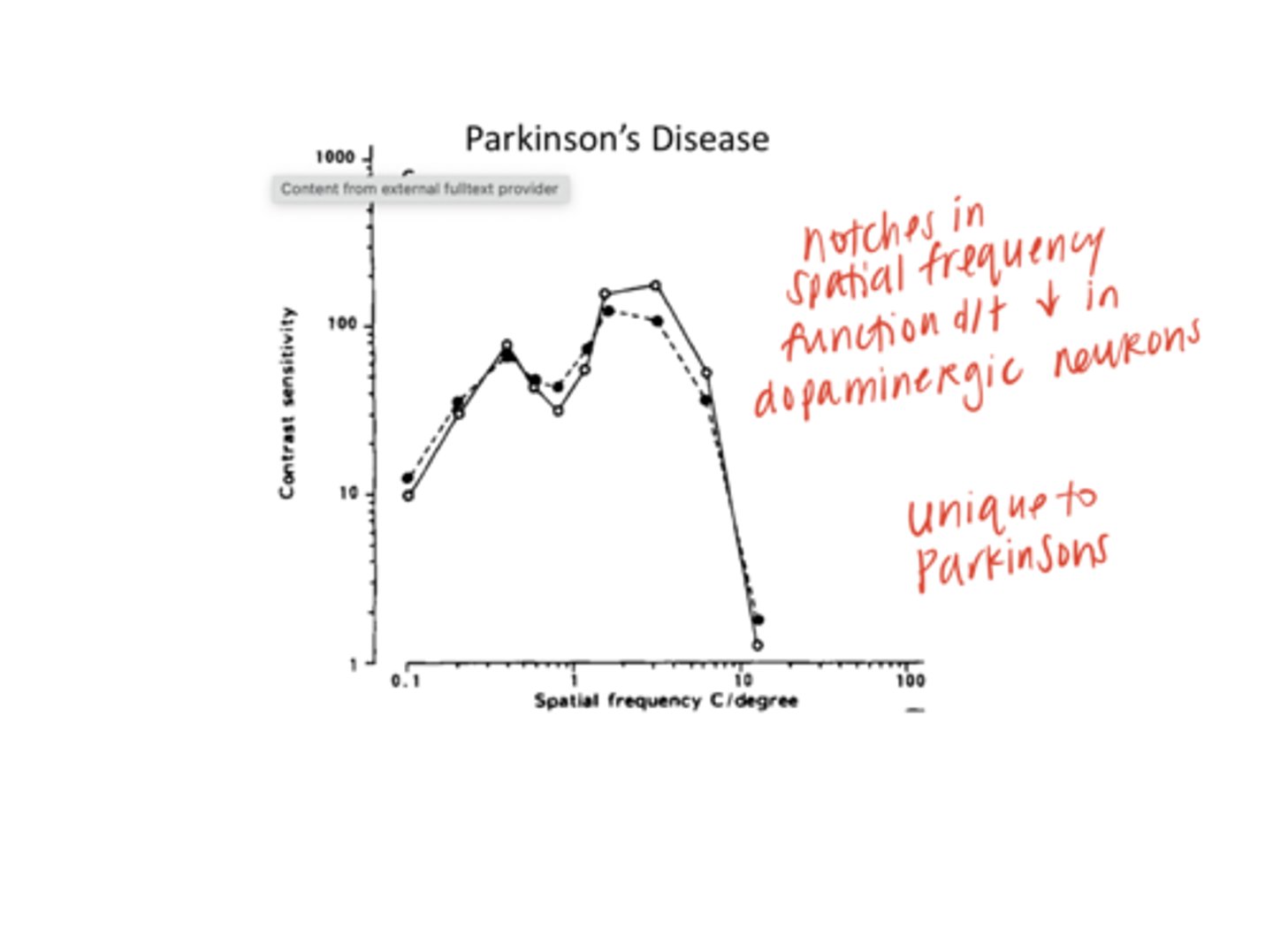<p>With Parkinson's, what will the contrast sensitivity v spatial frequency curve look like?</p>