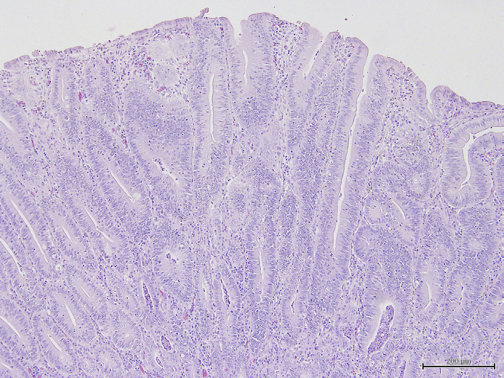 <p>Pigs necropsied after dieing from dehydration associated diarrhea. Path photos show elongated villi. </p>