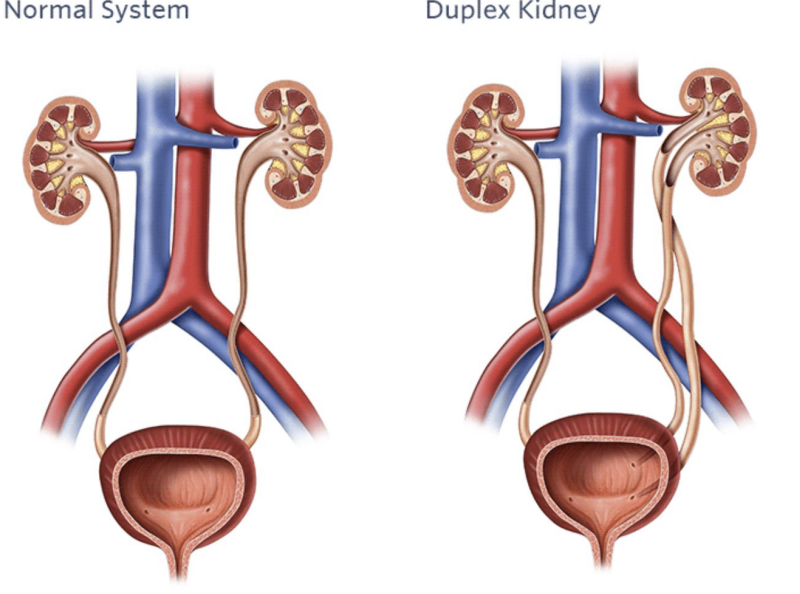 <p>Ureter </p>